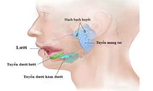 Viêm tuyến mang tai, Điều trị bệnh dứt điểm an toàn, Không tái phát